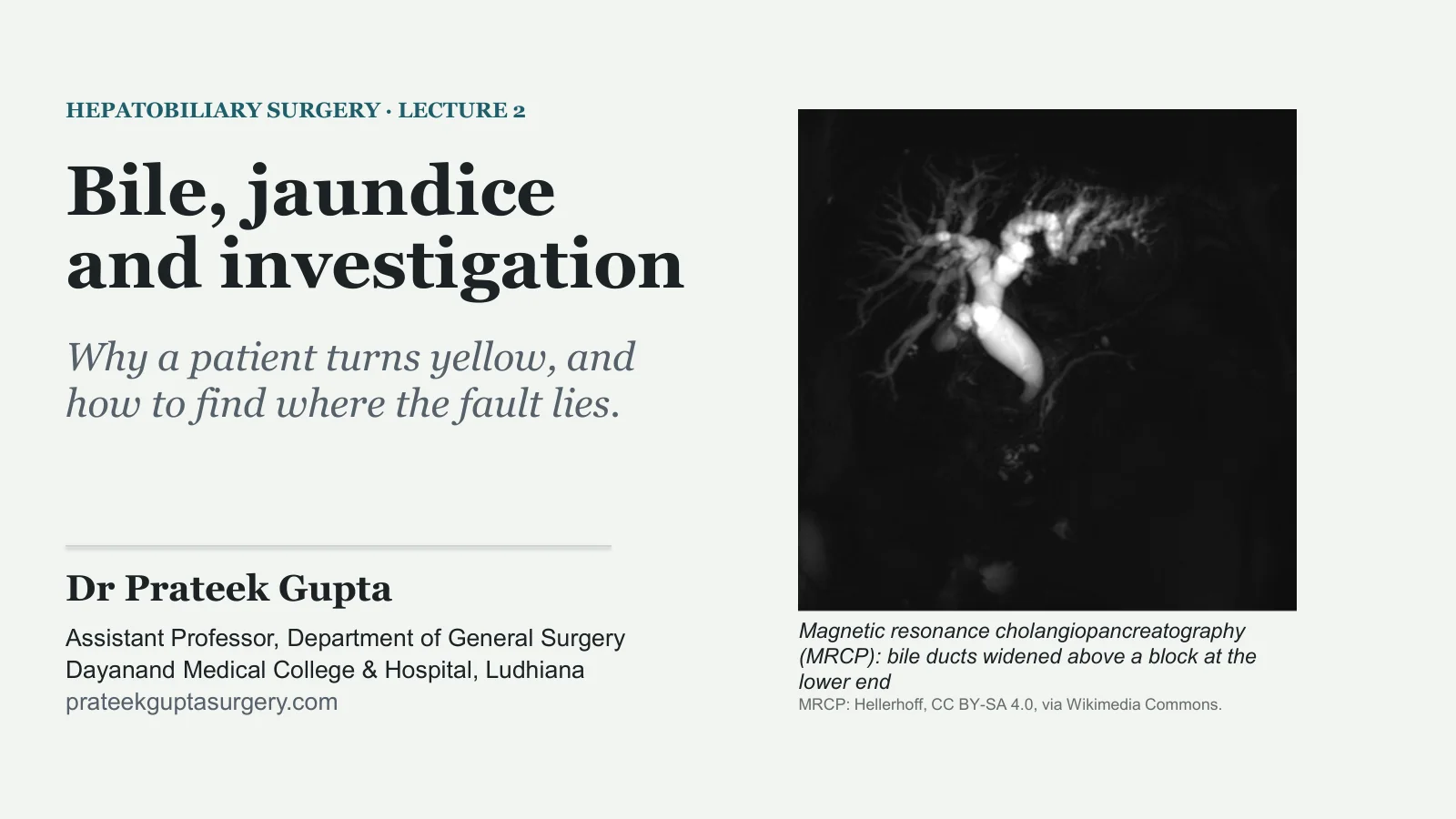 Slide 1: Bile, jaundice and investigation