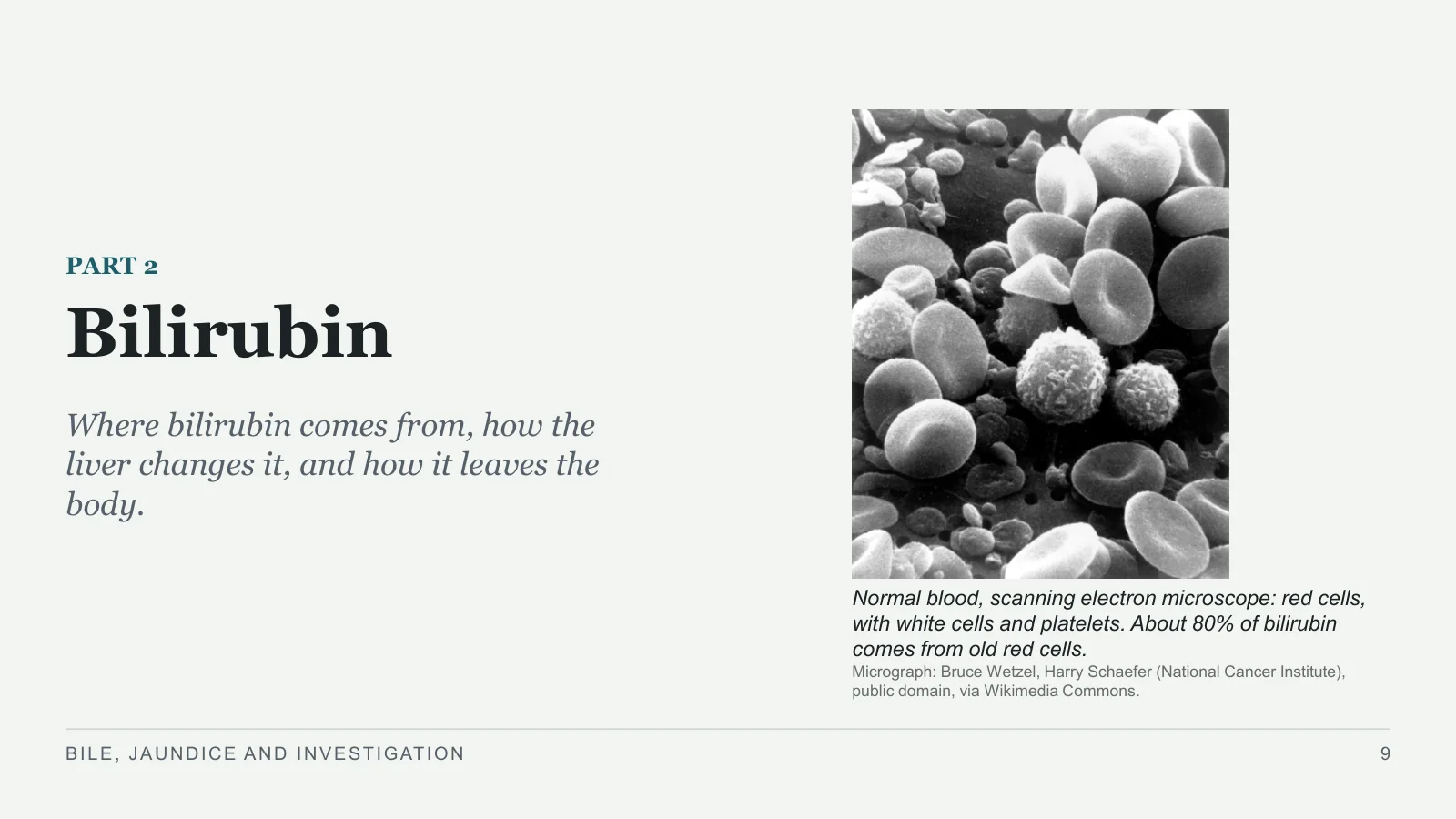 Slide 9: Bilirubin