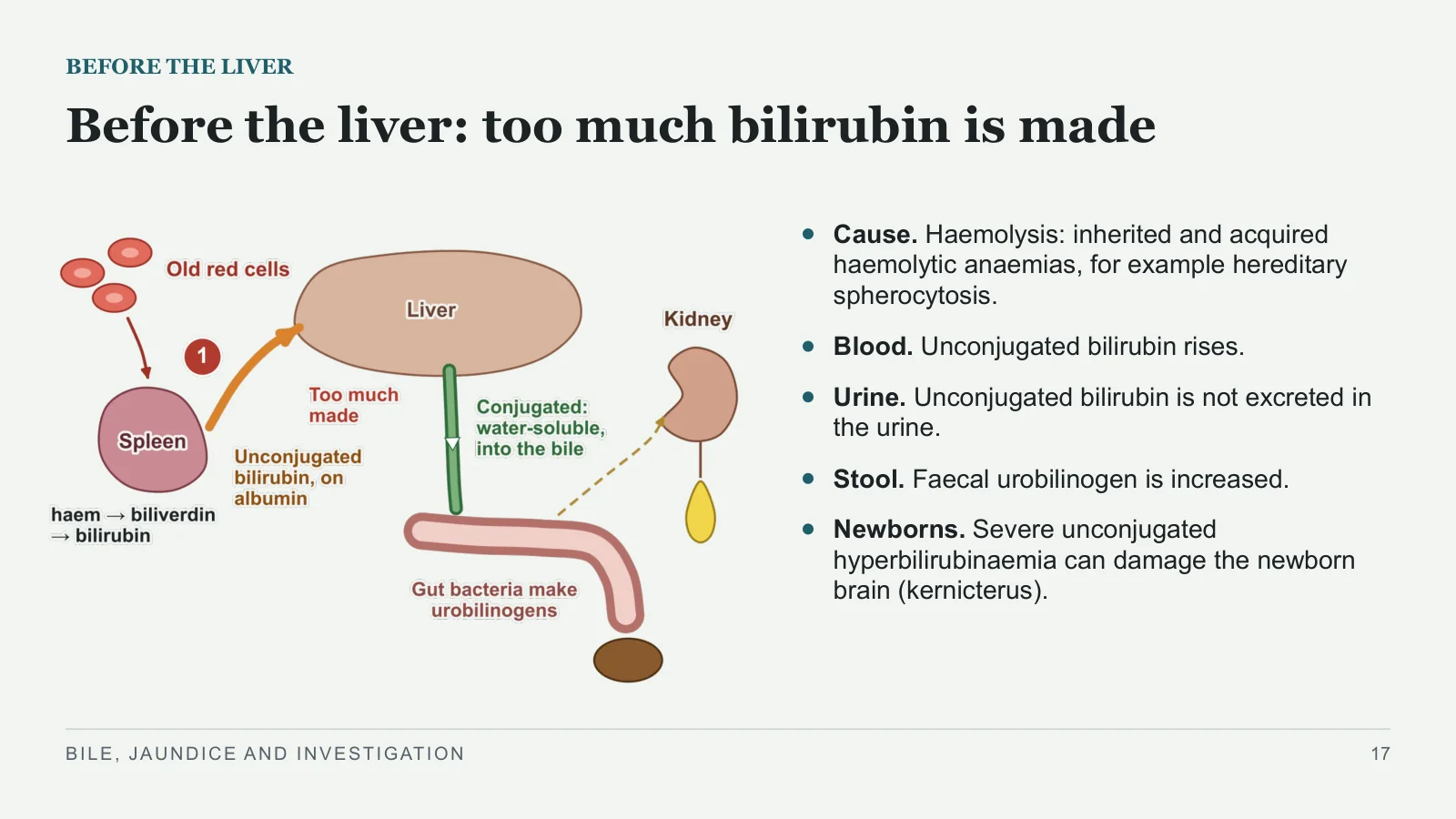 Slide 17: Before the liver: too much bilirubin is made