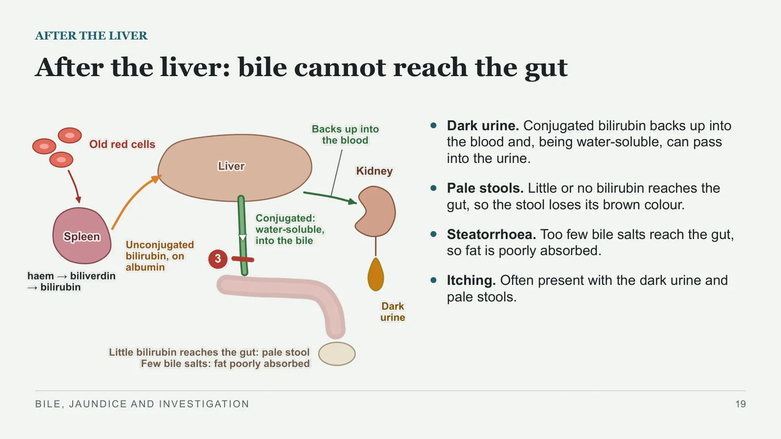 Slide 19: After the liver: bile cannot reach the gut