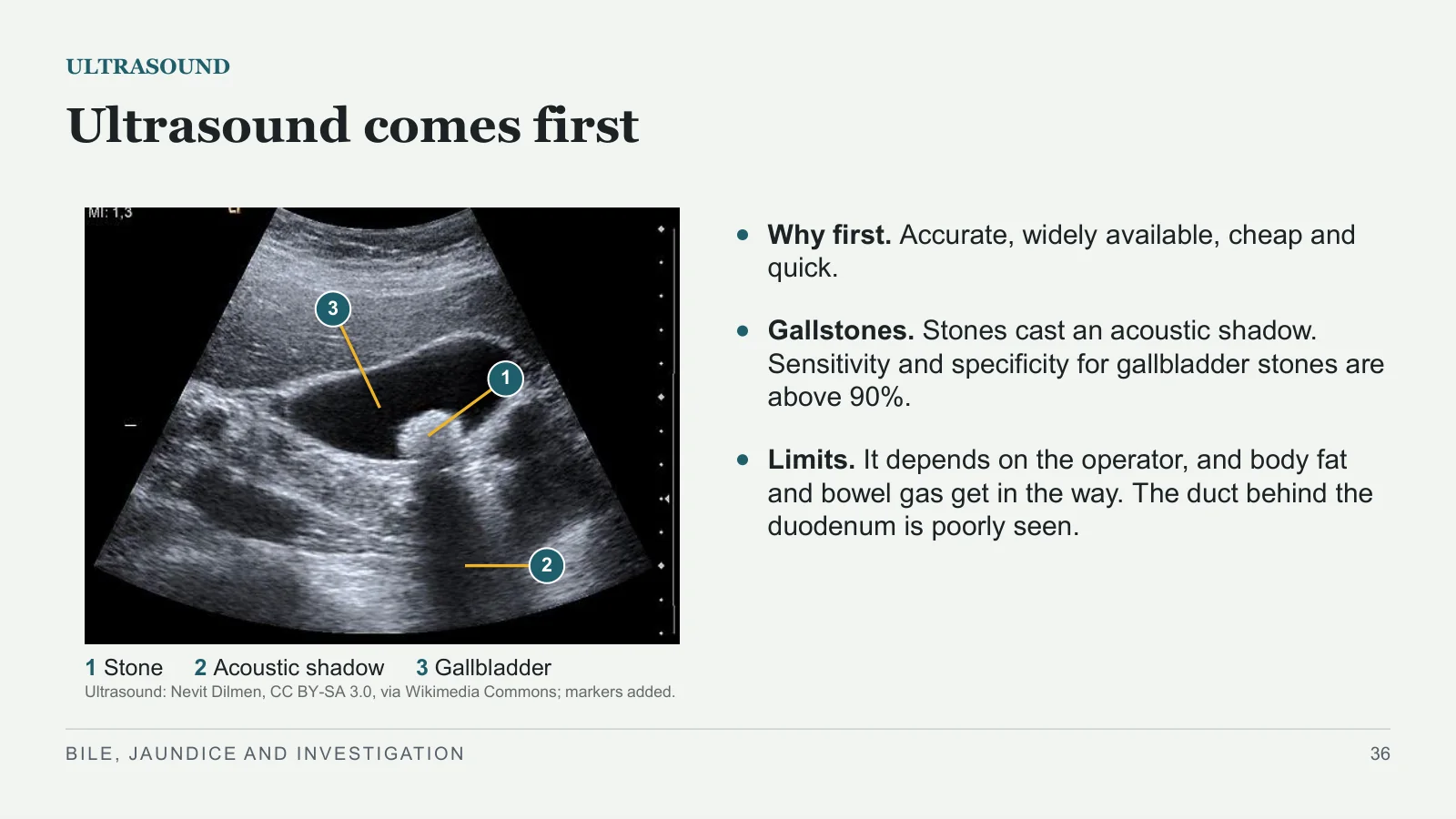 Slide 36: Ultrasound comes first