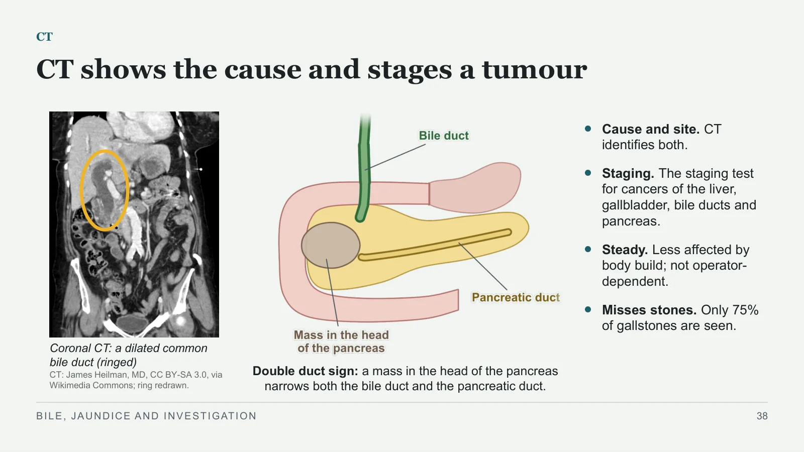 Slide 38: CT shows the cause and stages a tumour