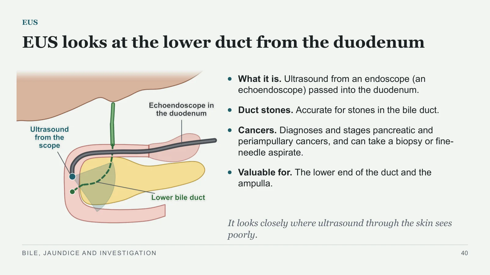 Slide 40: EUS looks at the lower duct from the duodenum
