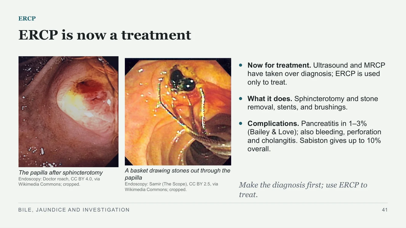 Slide 41: ERCP is now a treatment