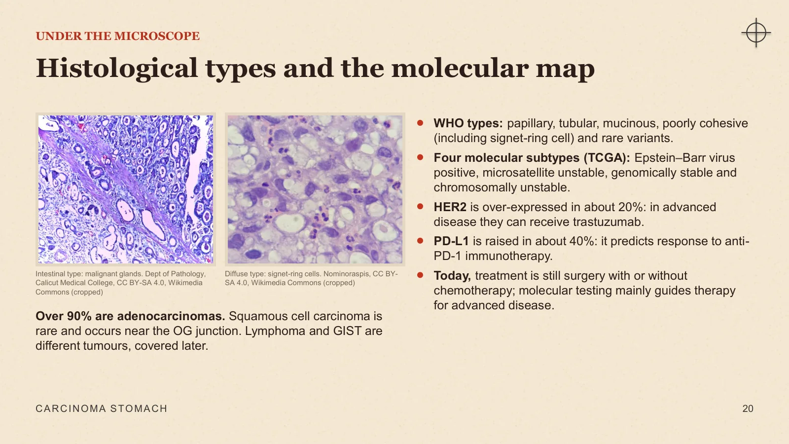 Slide 20: Histological types and the molecular map