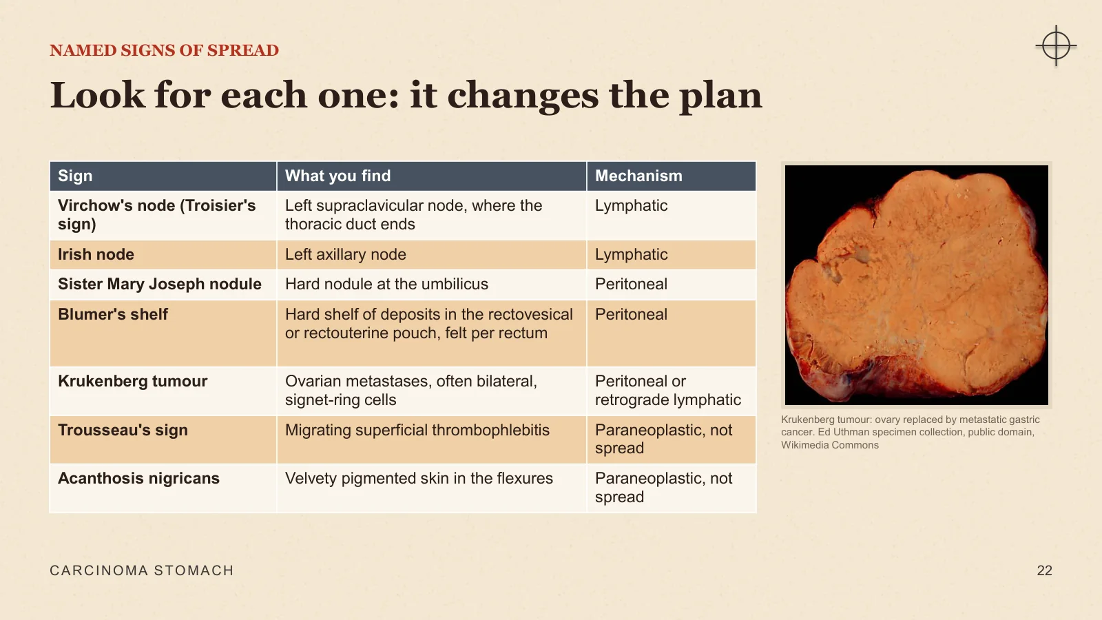 Slide 22: Look for each one: it changes the plan