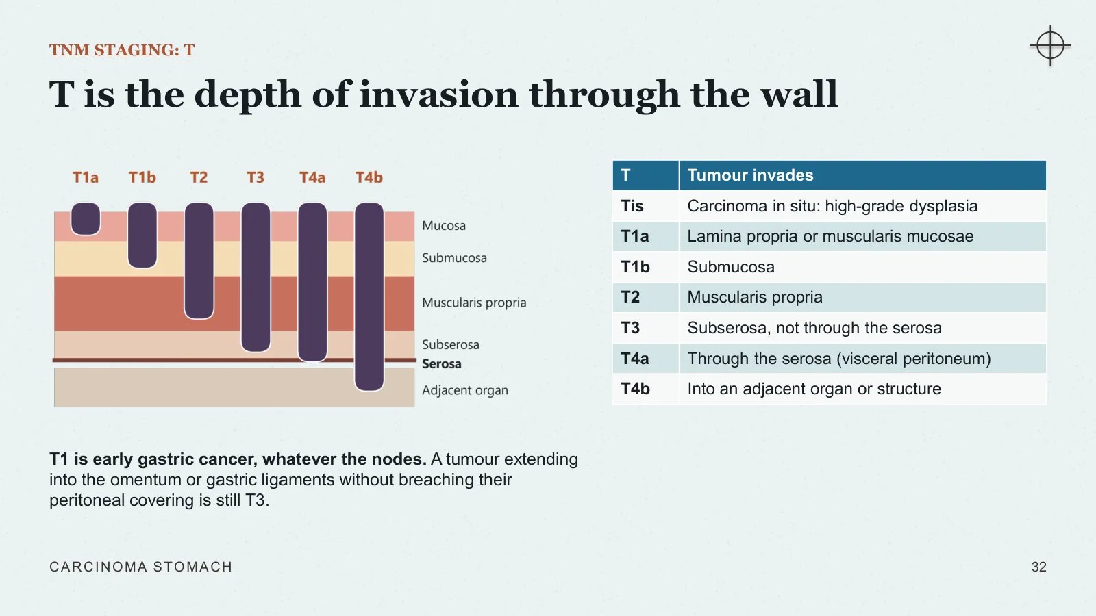 Slide 32: T is the depth of invasion through the wall
