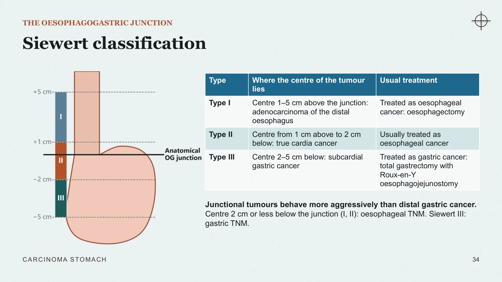 Slide 34: Siewert classification