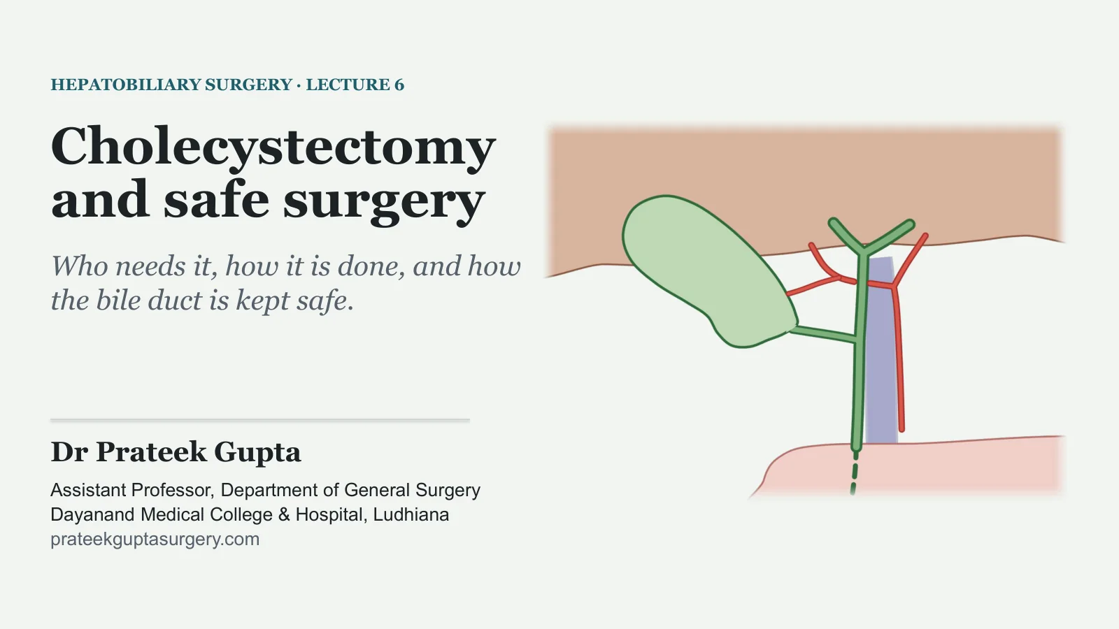 Slide 1: Cholecystectomy and safe surgery