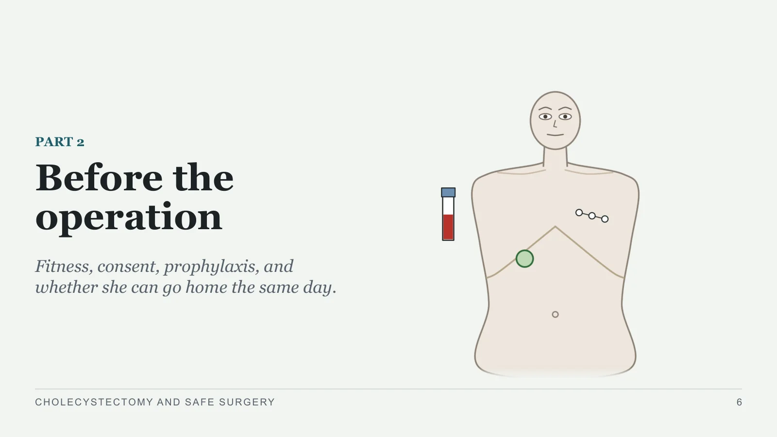 Slide 6: Before the operation