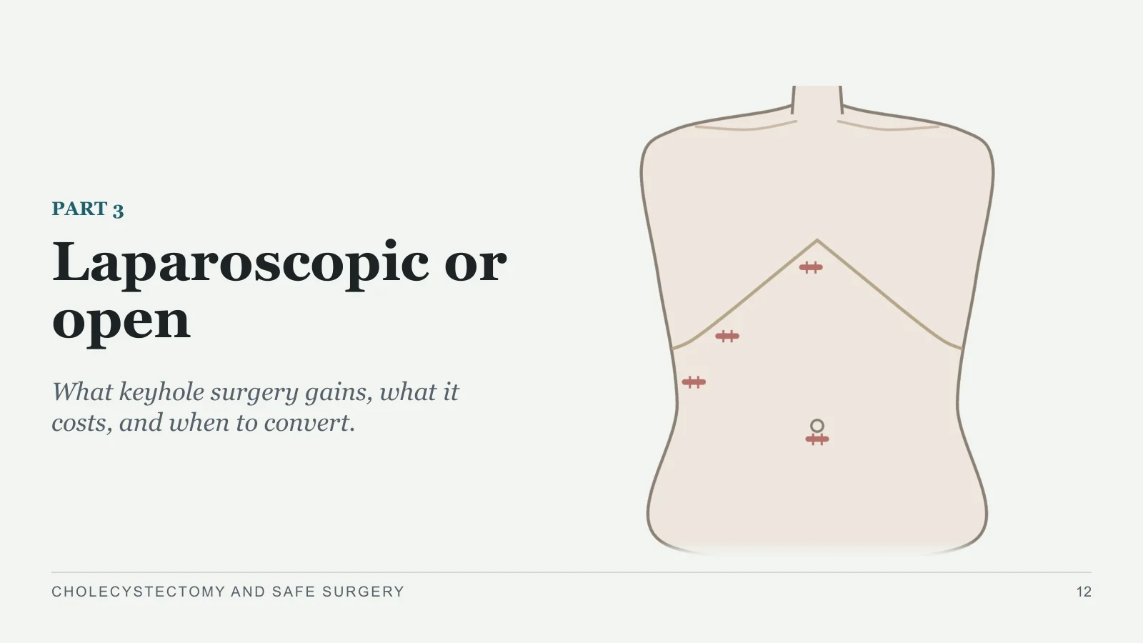 Slide 12: Laparoscopic or open