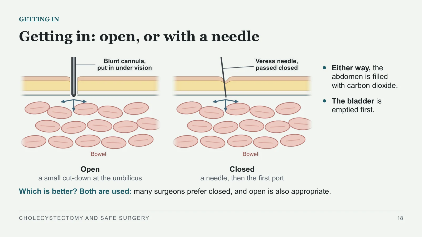 Slide 18: Getting in: open, or with a needle