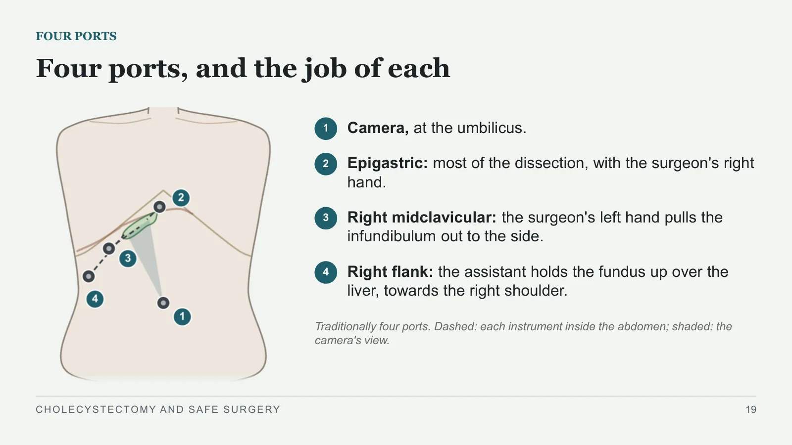 Slide 19: Four ports, and the job of each