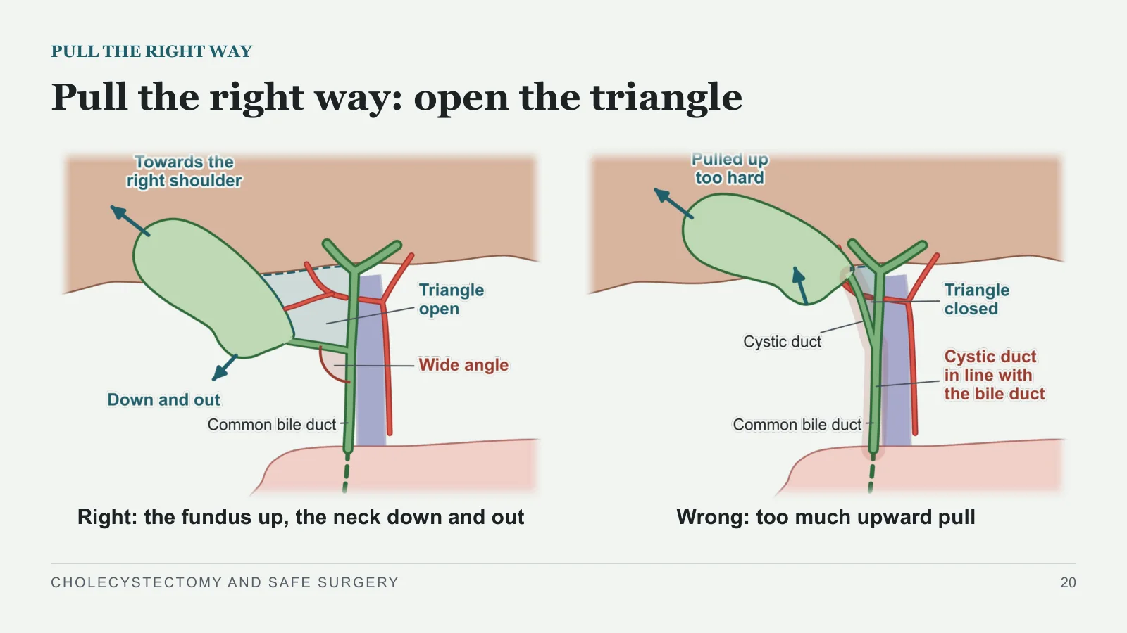 Slide 20: Pull the right way: open the triangle