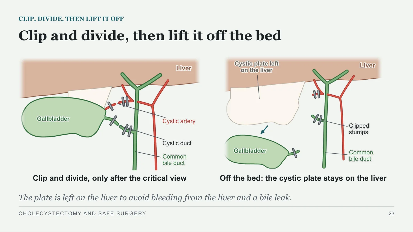 Slide 23: Clip and divide, then lift it off the bed