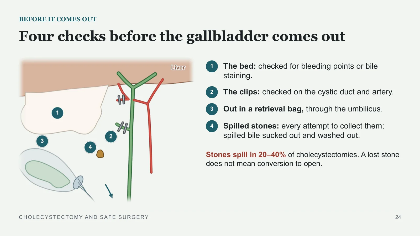 Slide 24: Four checks before the gallbladder comes out
