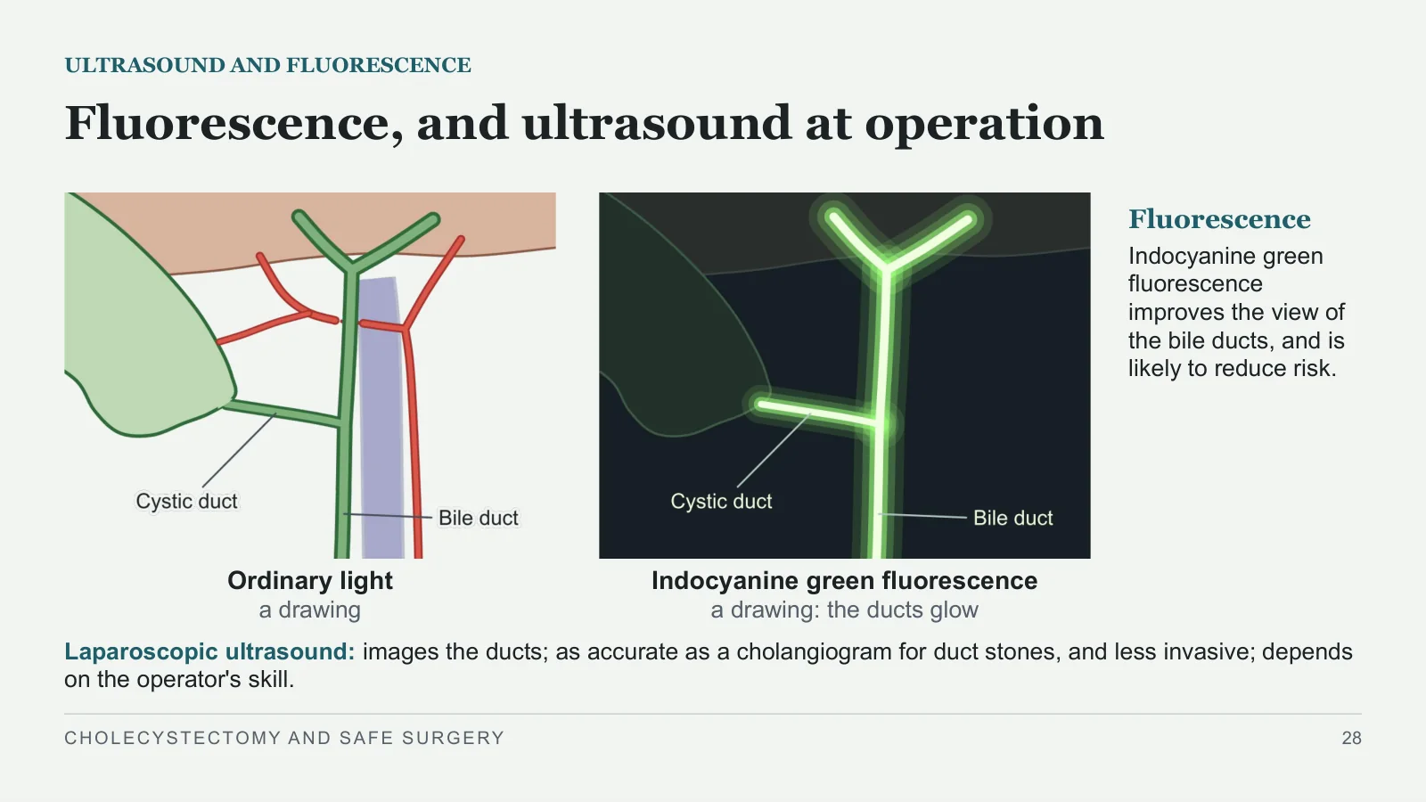 Slide 28: Fluorescence, and ultrasound at operation