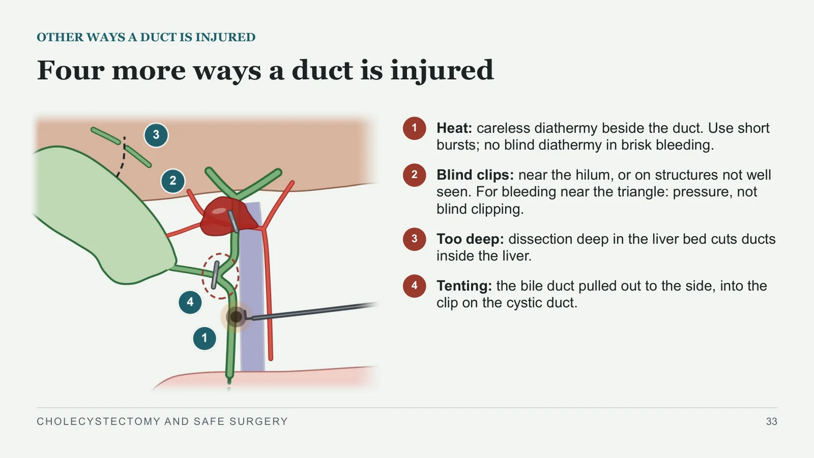Slide 33: Four more ways a duct is injured