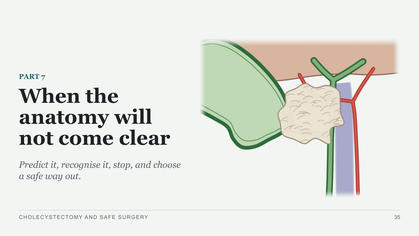 Slide 35: When the anatomy will not come clear