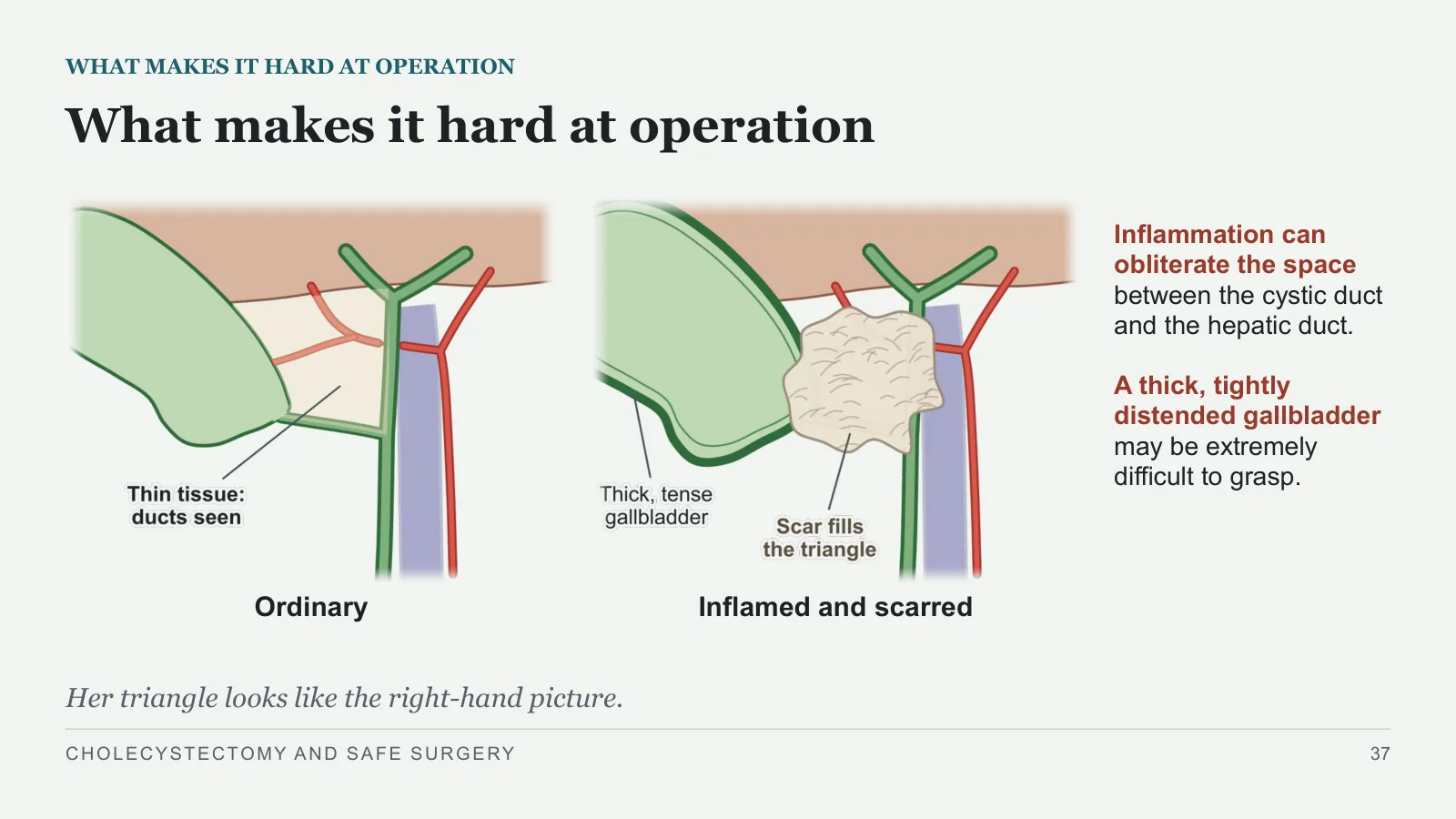 Slide 37: What makes it hard at operation