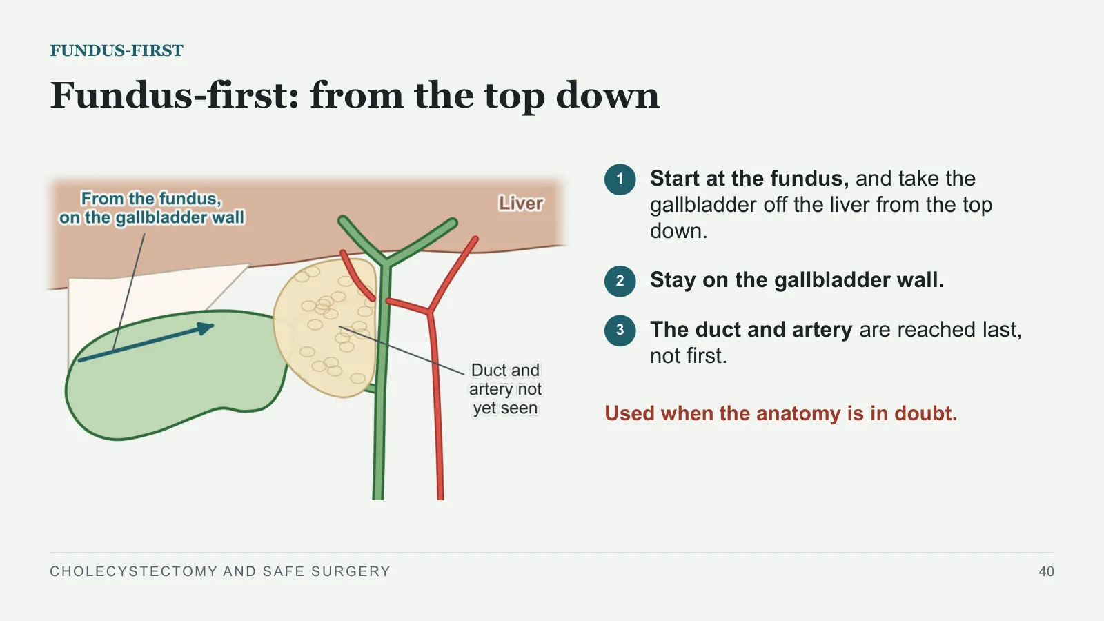 Slide 40: Fundus-first: from the top down