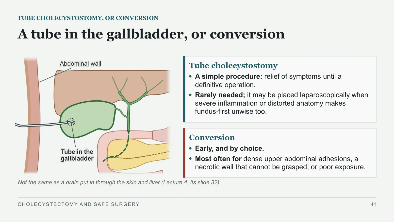 Slide 41: A tube in the gallbladder, or conversion