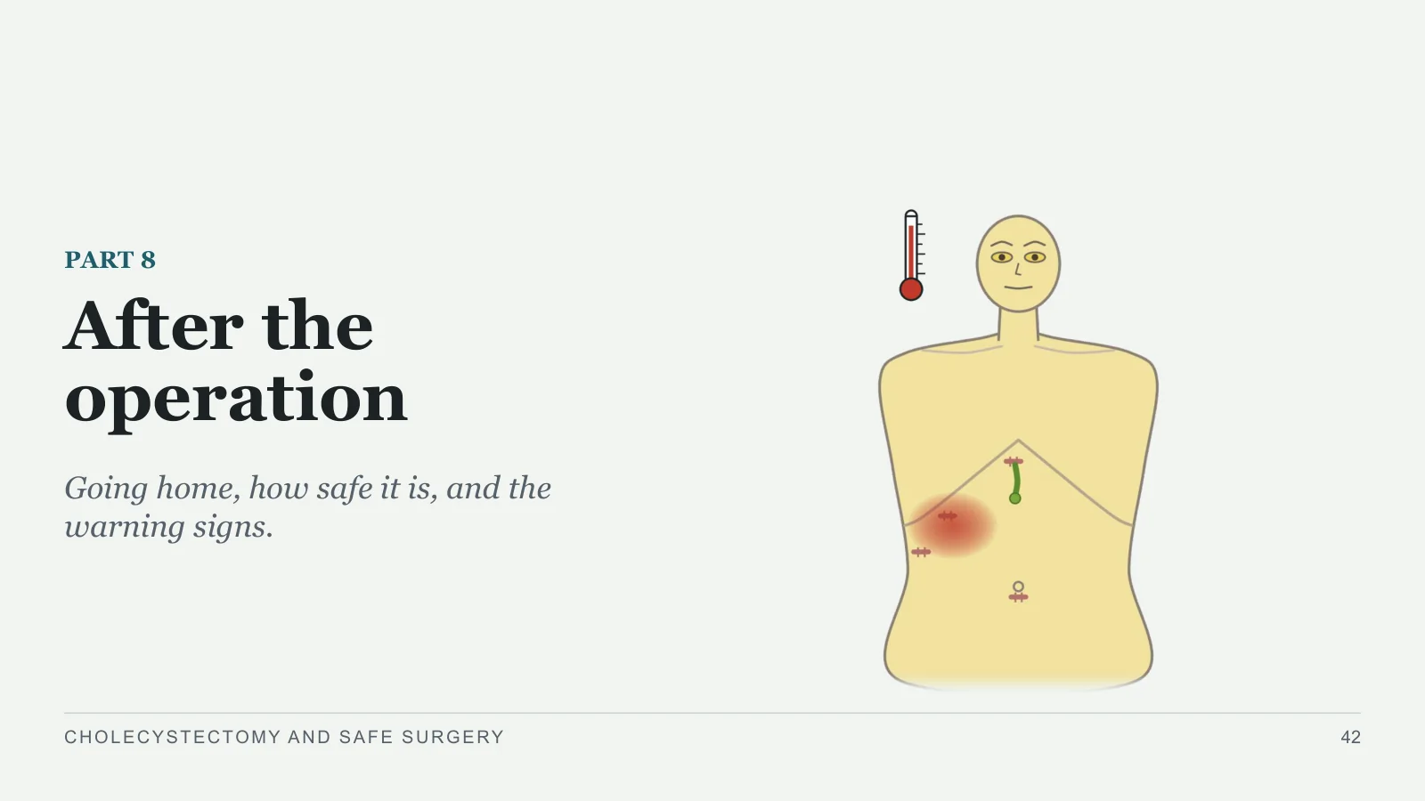 Slide 42: After the operation