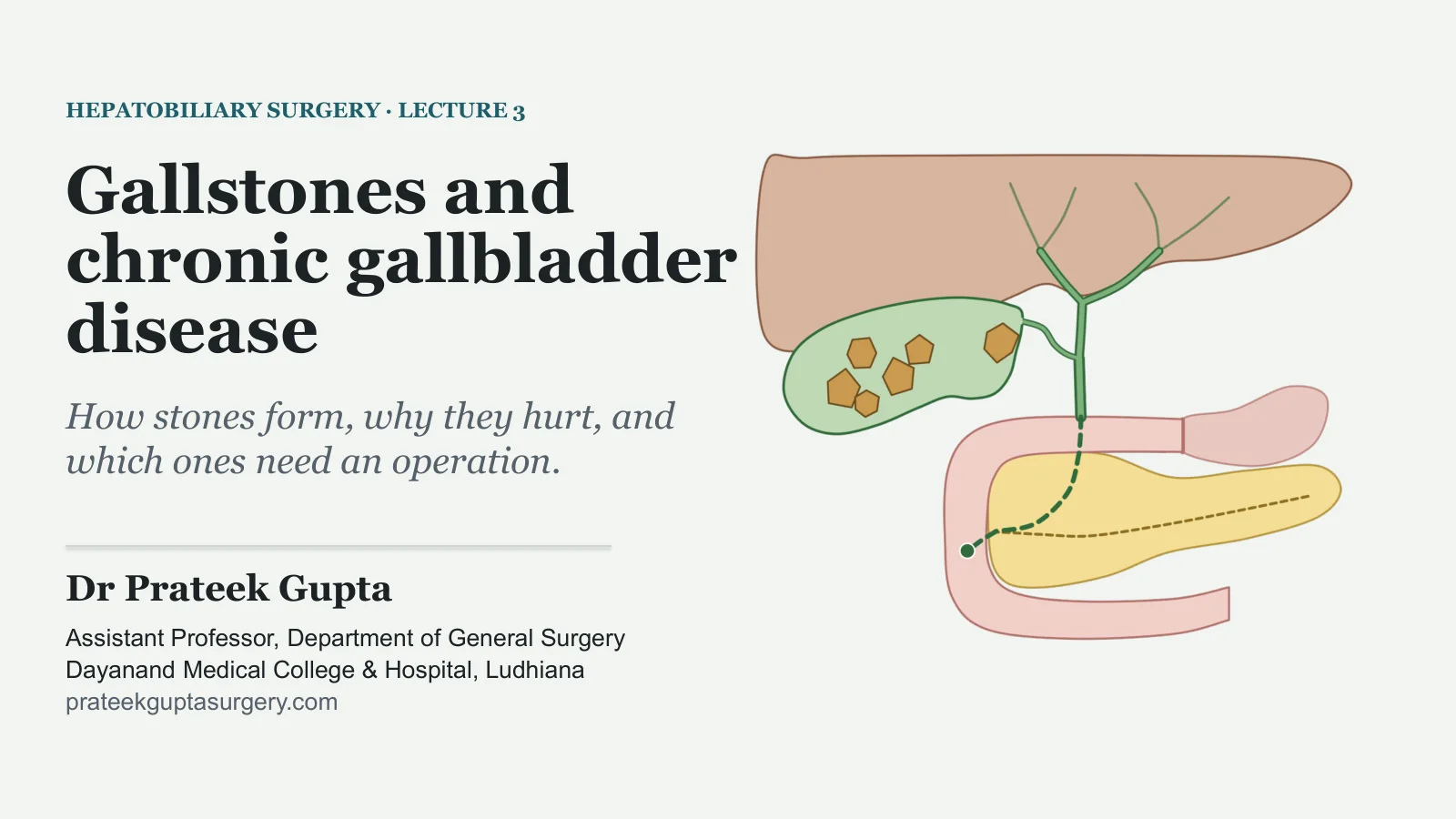 Slide 1: Gallstones and chronic gallbladder disease