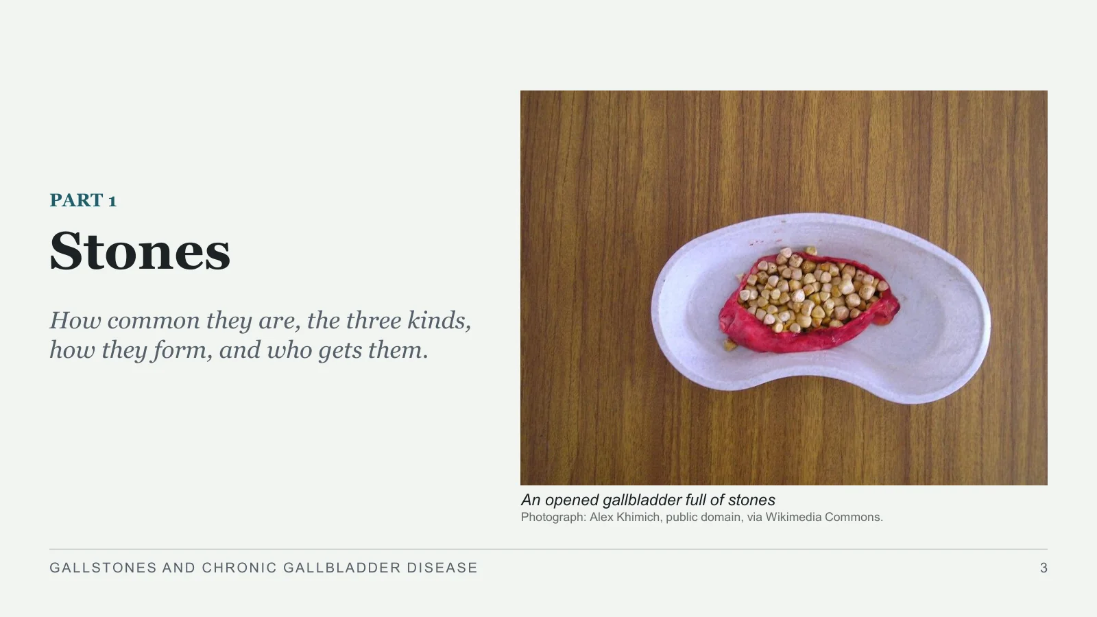 Slide 3: Stones