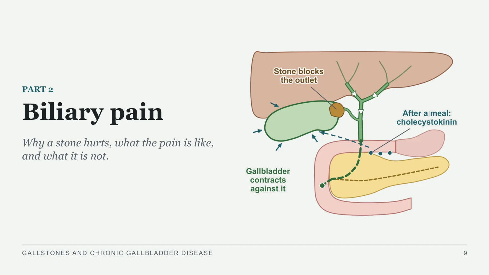Slide 9: Biliary pain