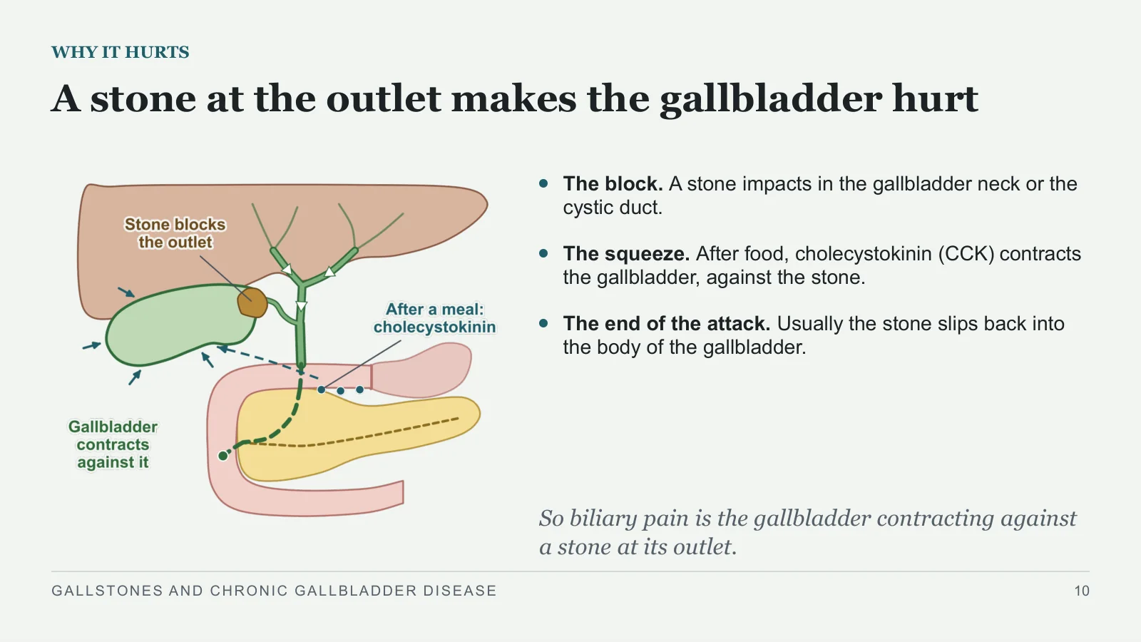 Slide 10: A stone at the outlet makes the gallbladder hurt