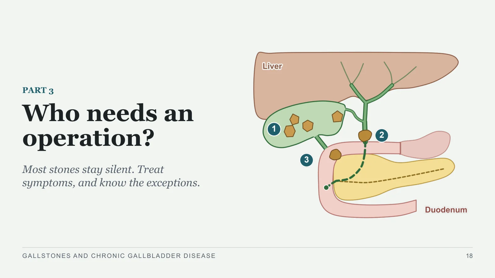 Slide 18: Who needs an operation?