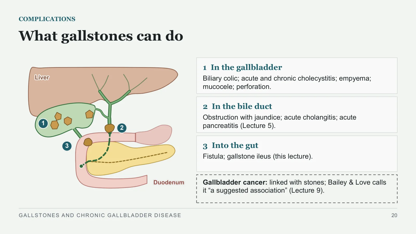 Slide 20: What gallstones can do