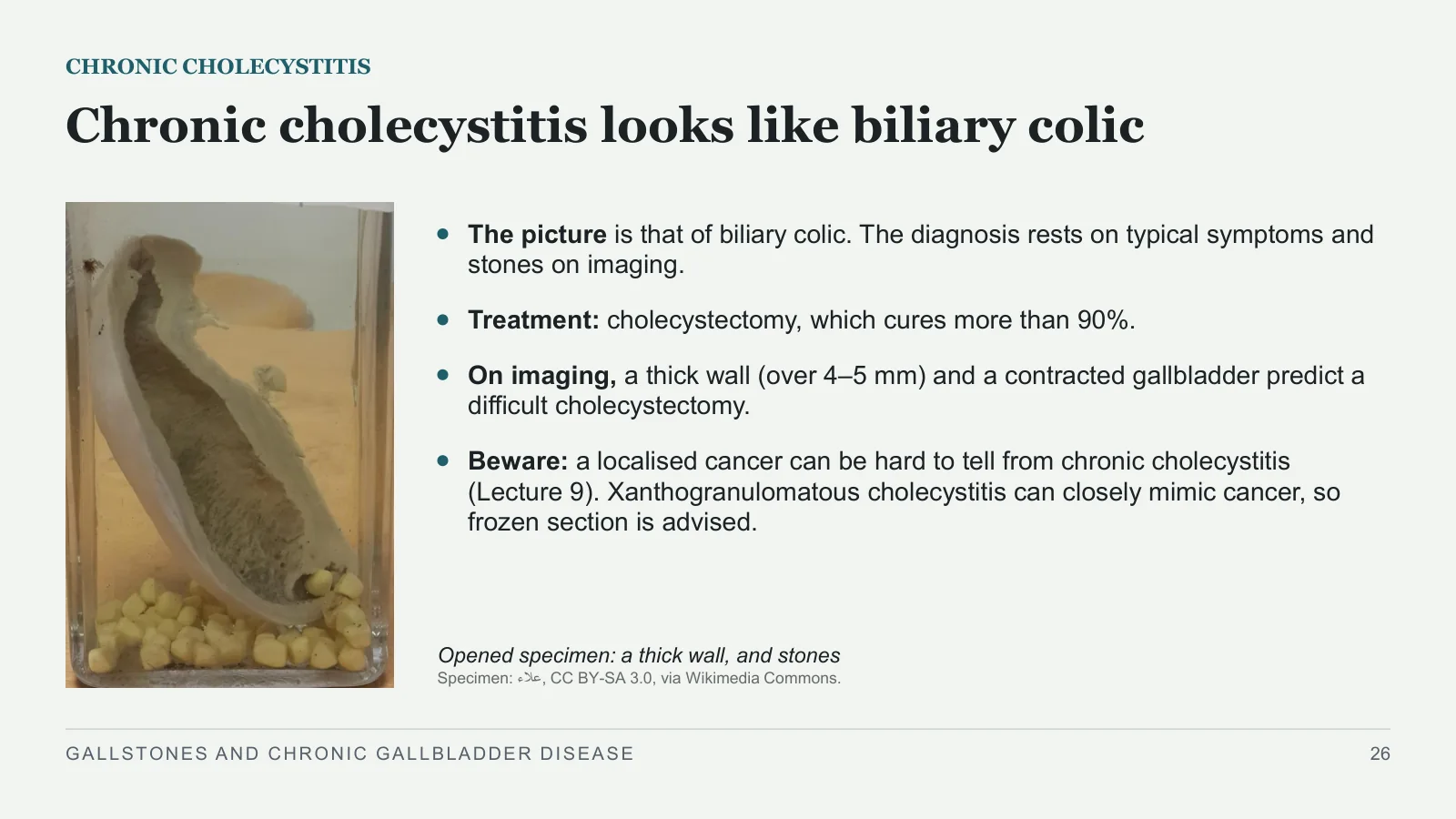 Slide 26: Chronic cholecystitis looks like biliary colic