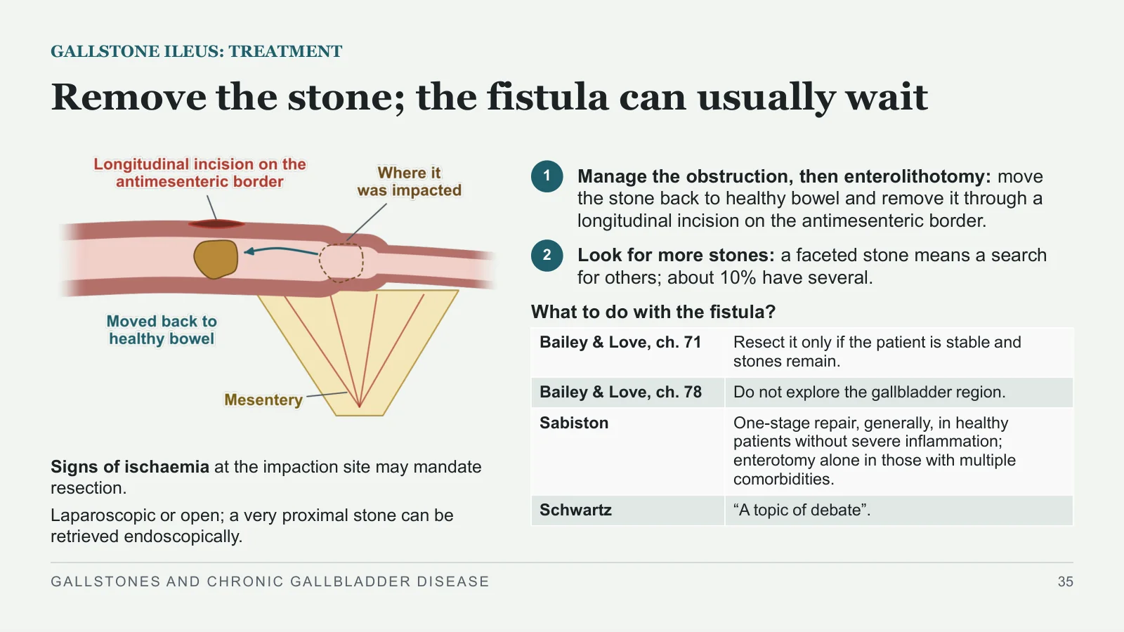 Slide 35: Remove the stone; the fistula can usually wait