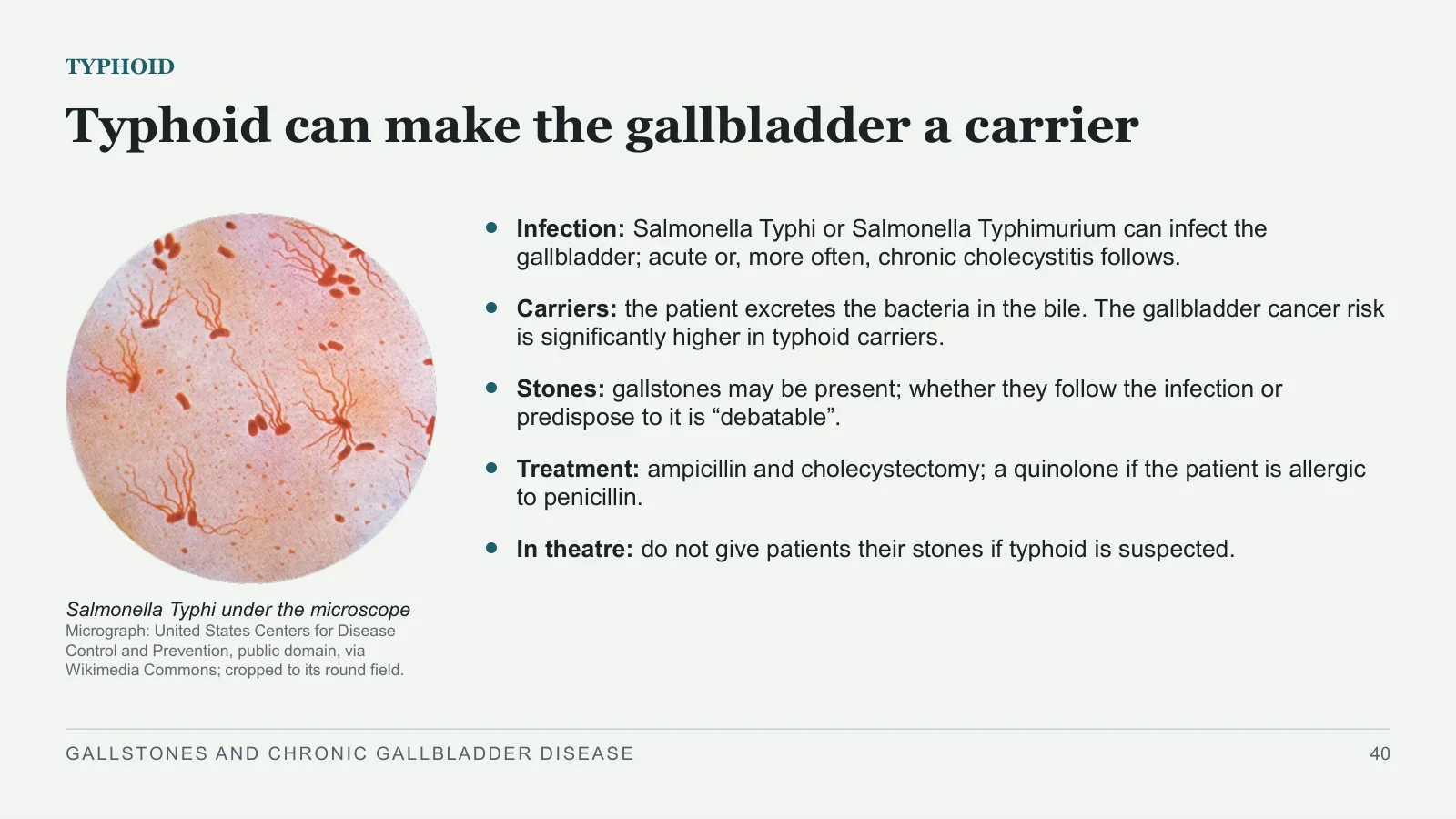 Slide 40: Typhoid can make the gallbladder a carrier