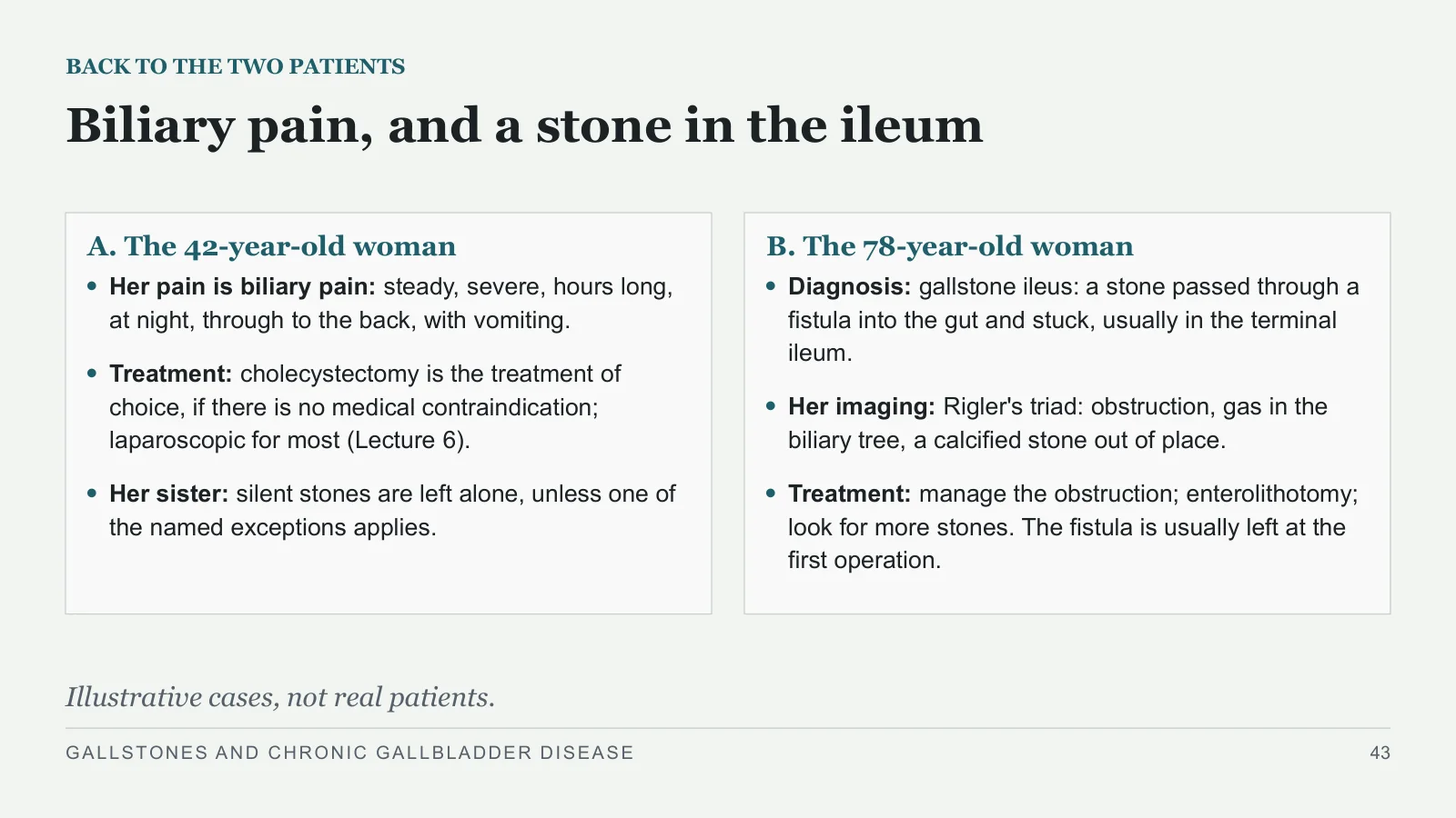 Slide 43: Biliary pain, and a stone in the ileum