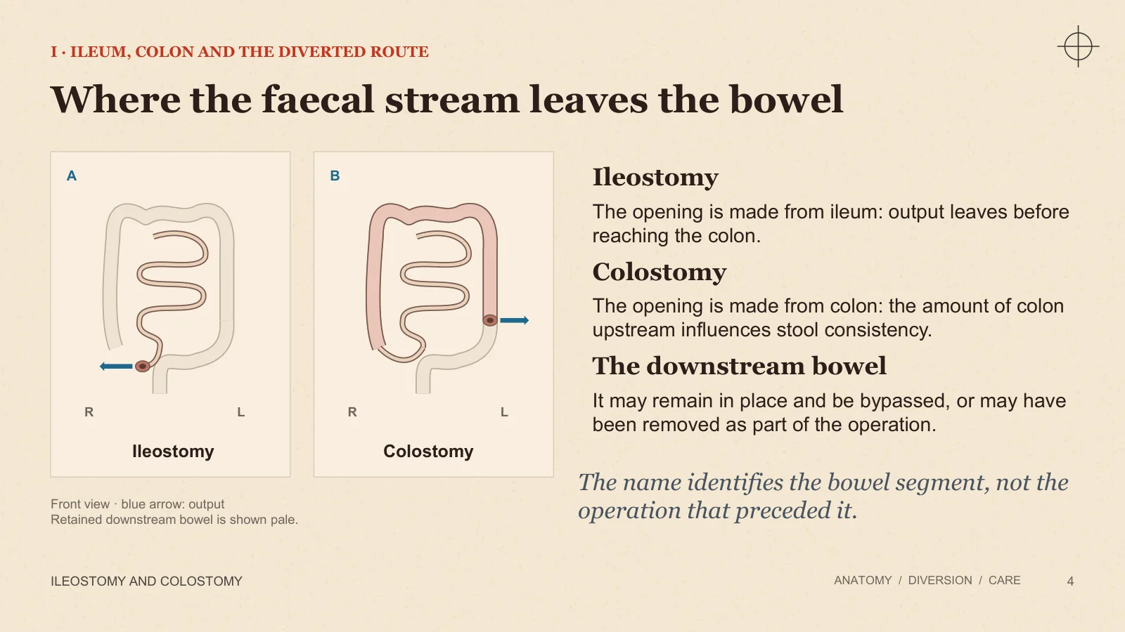 Slide 4: Where the faecal stream leaves the bowel