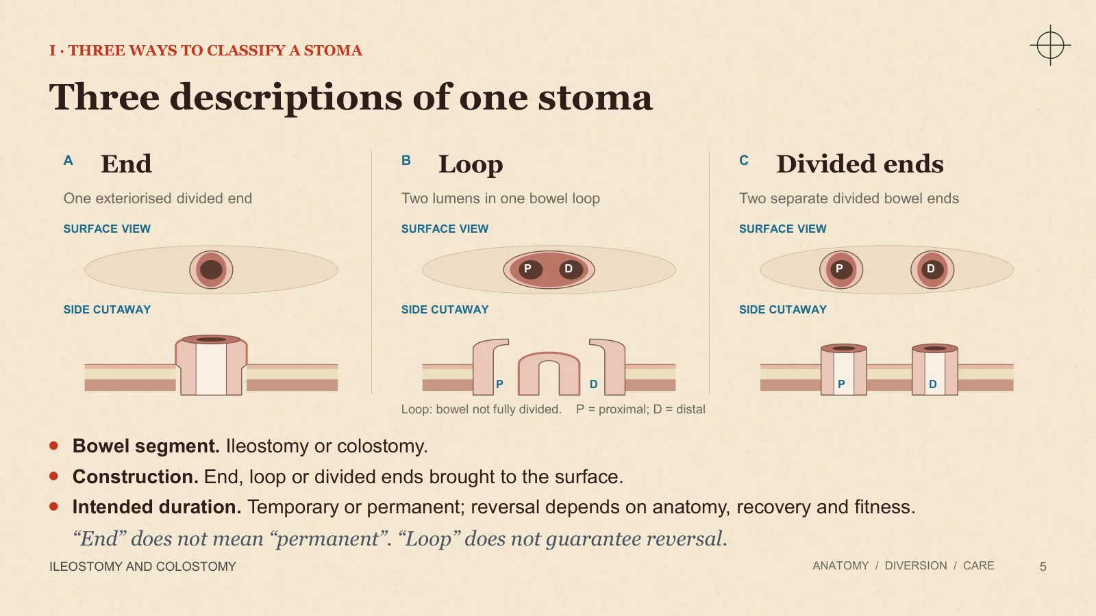 Slide 5: Three descriptions of one stoma