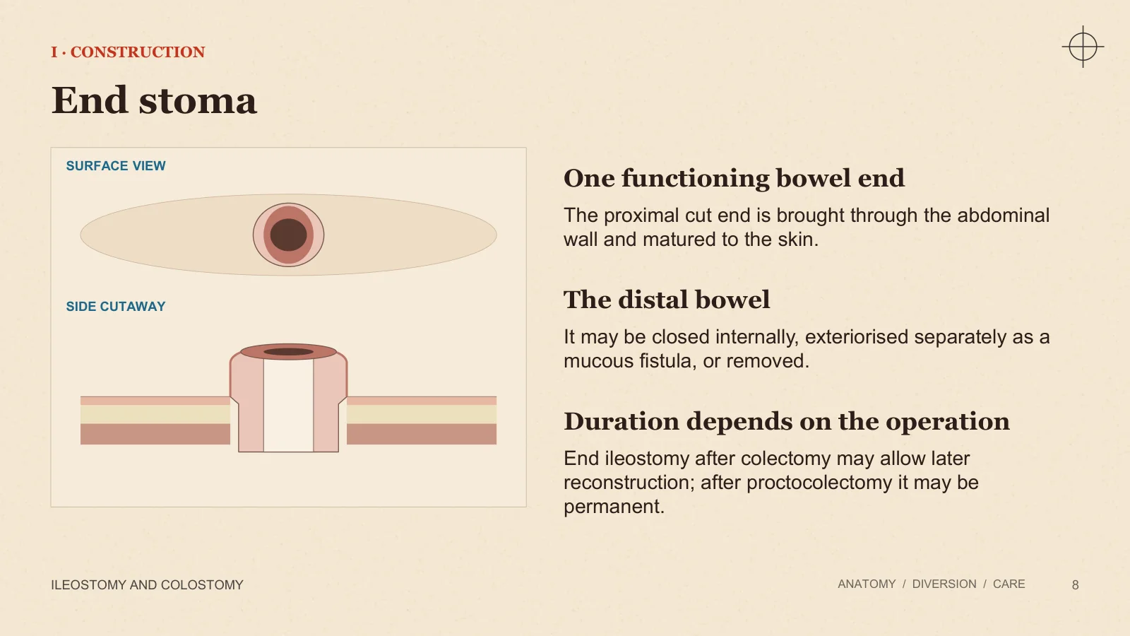 Slide 8: End stoma