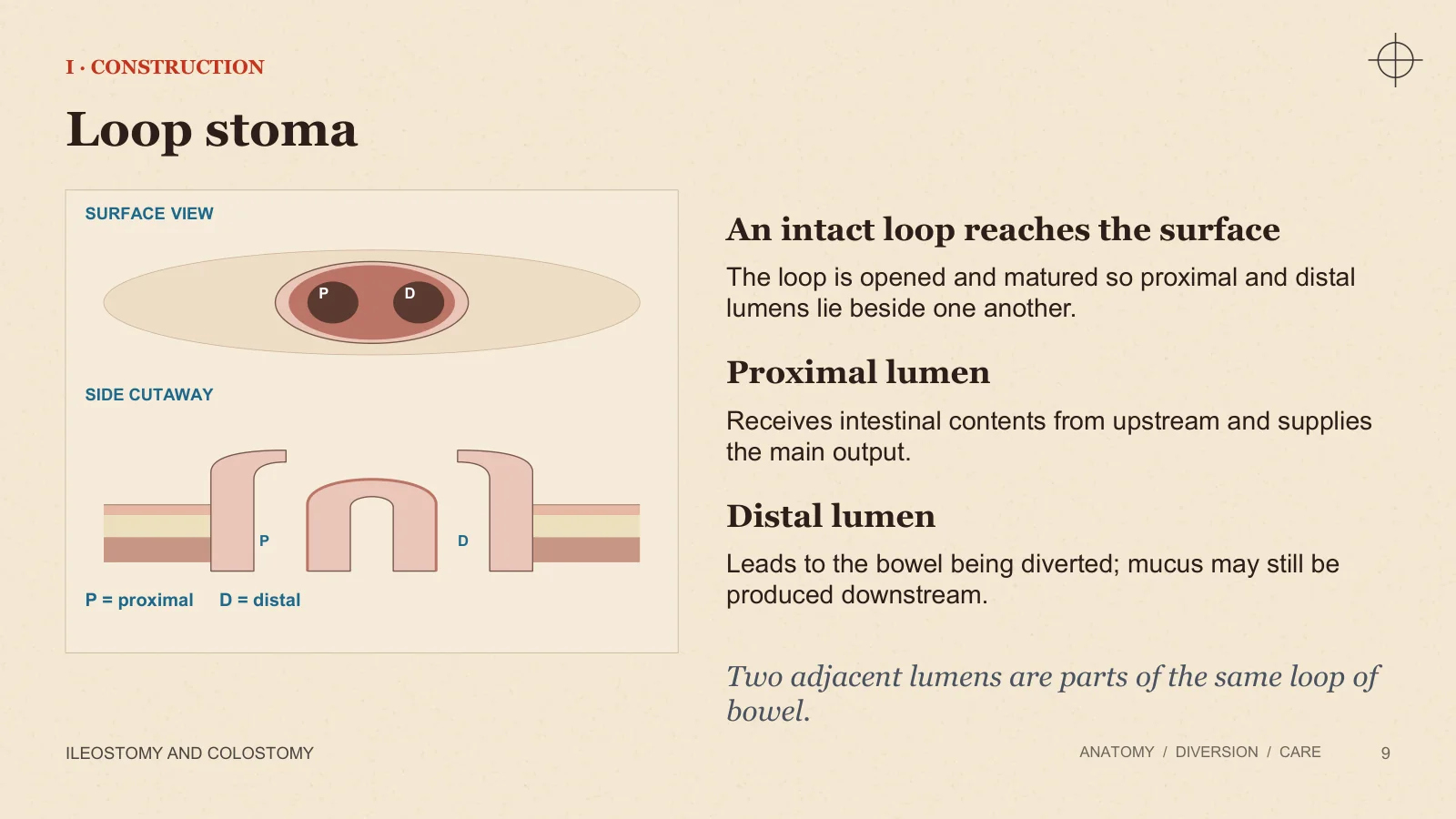 Slide 9: Loop stoma