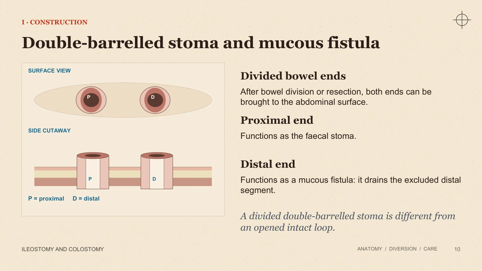 Slide 10: Double-barrelled stoma and mucous fistula