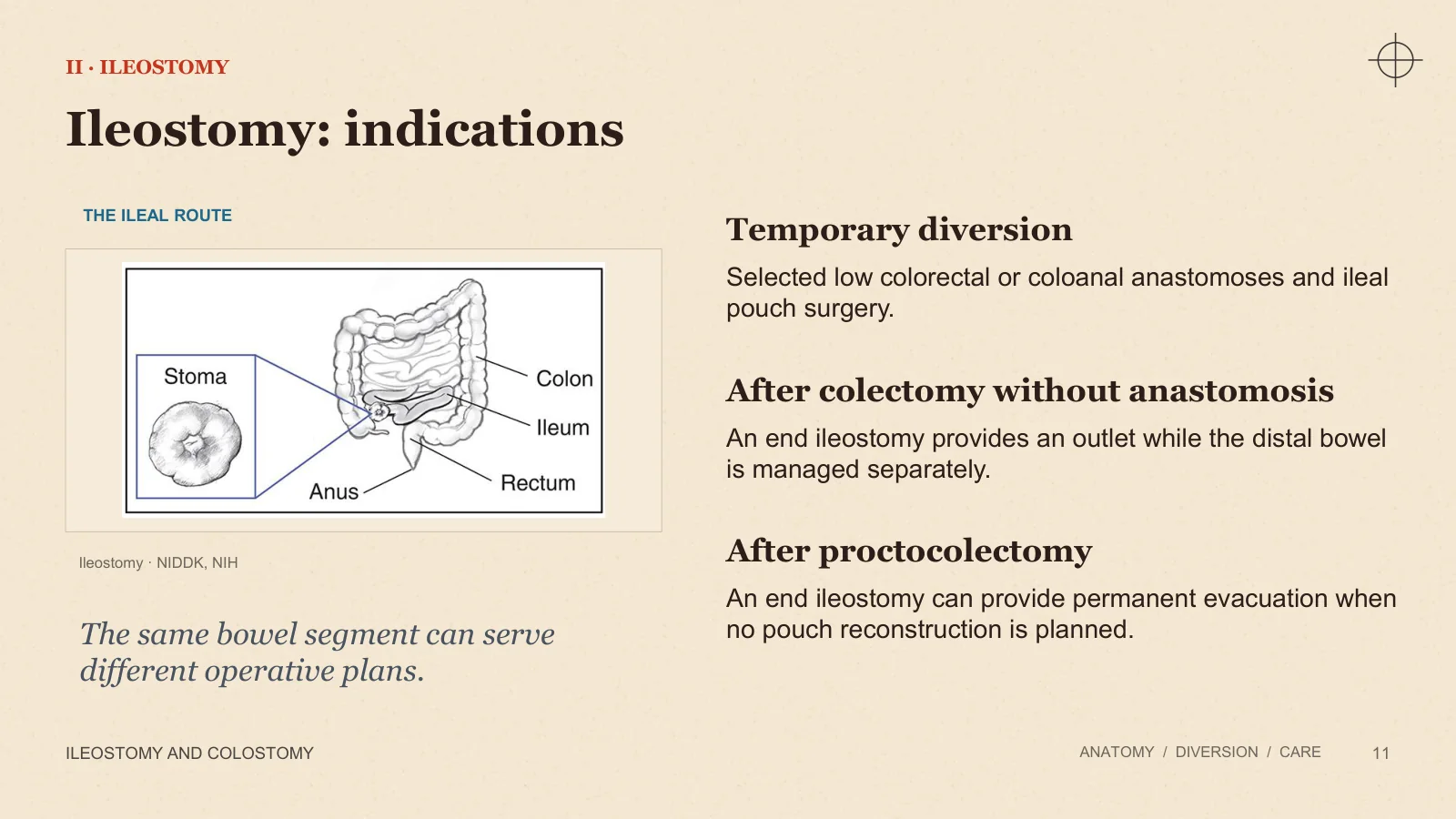 Slide 11: Ileostomy: indications