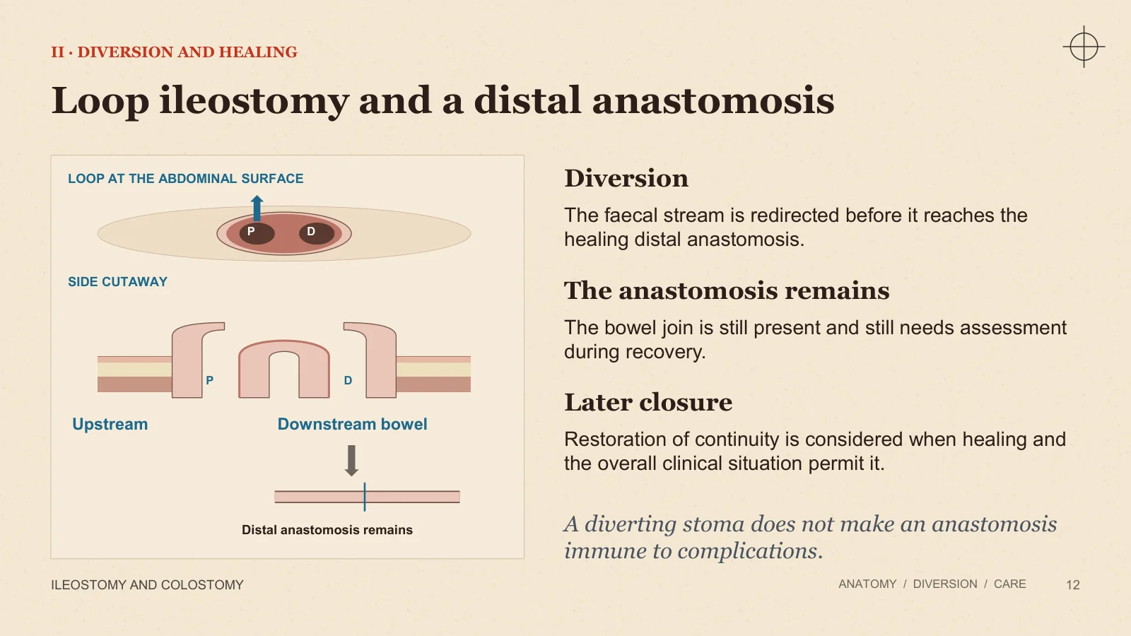 Slide 12: Loop ileostomy and a distal anastomosis