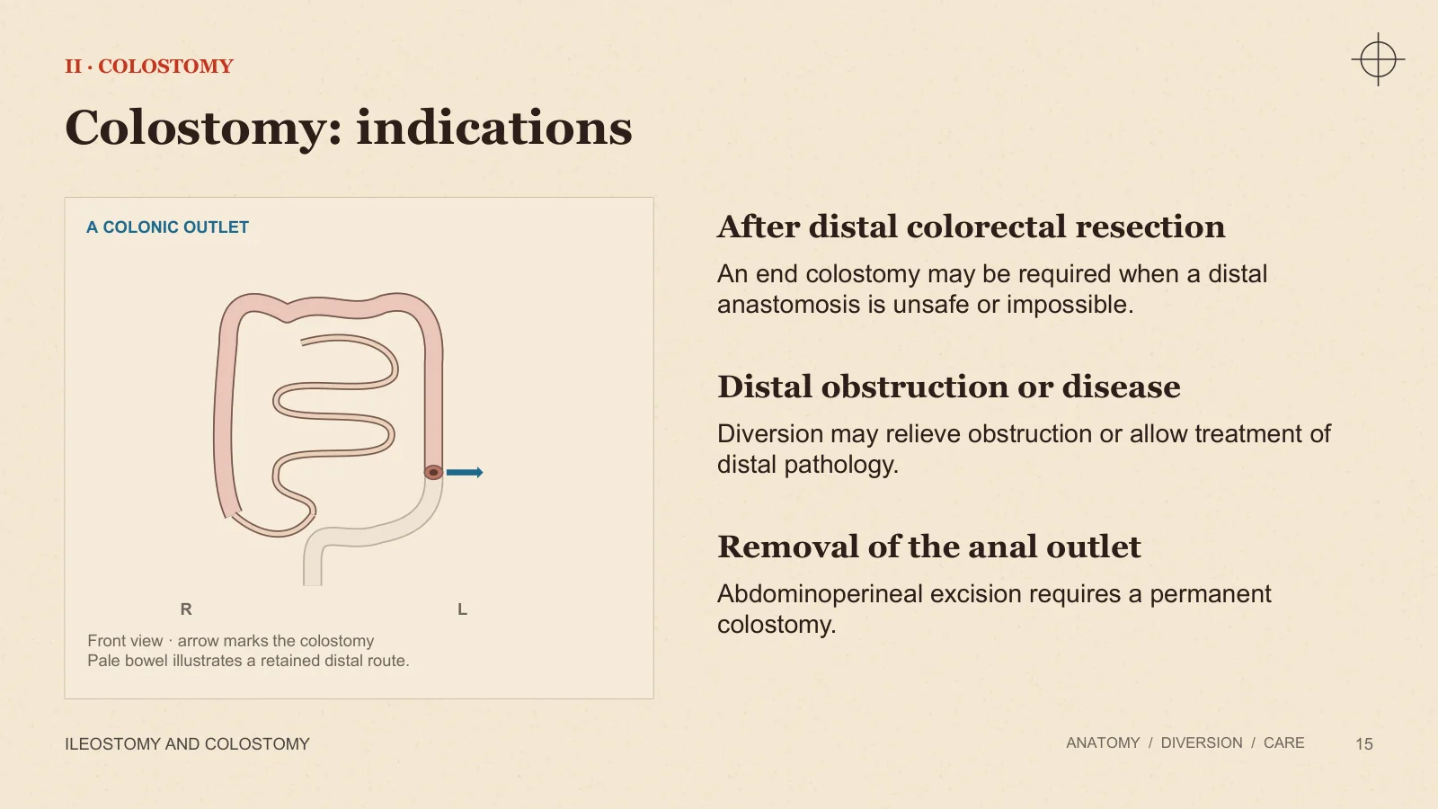 Slide 15: Colostomy: indications