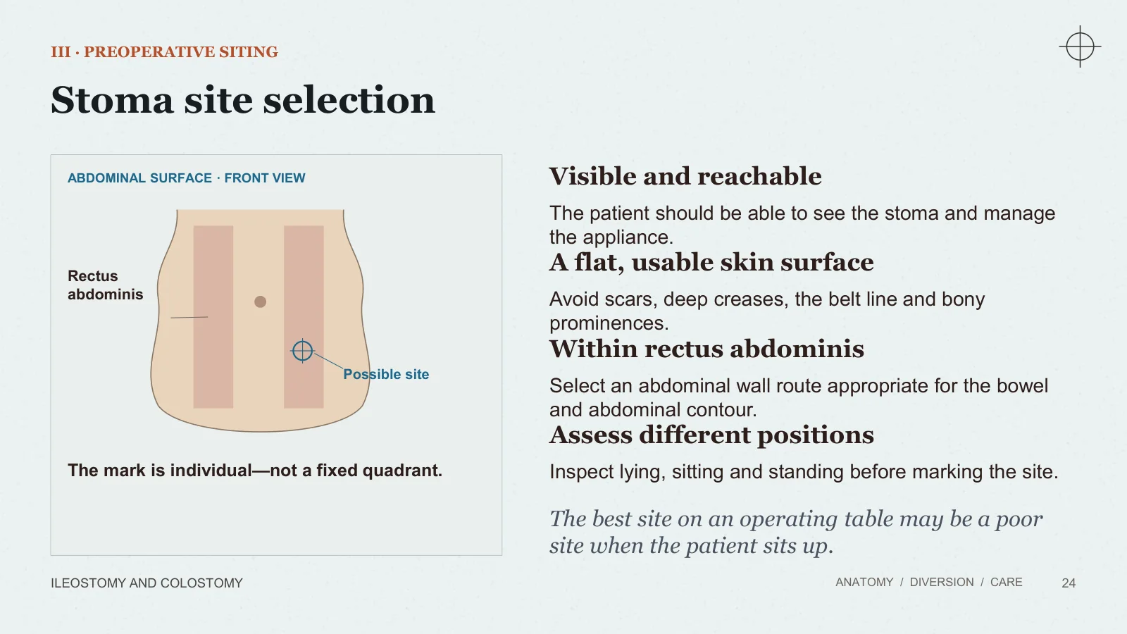 Slide 24: Stoma site selection