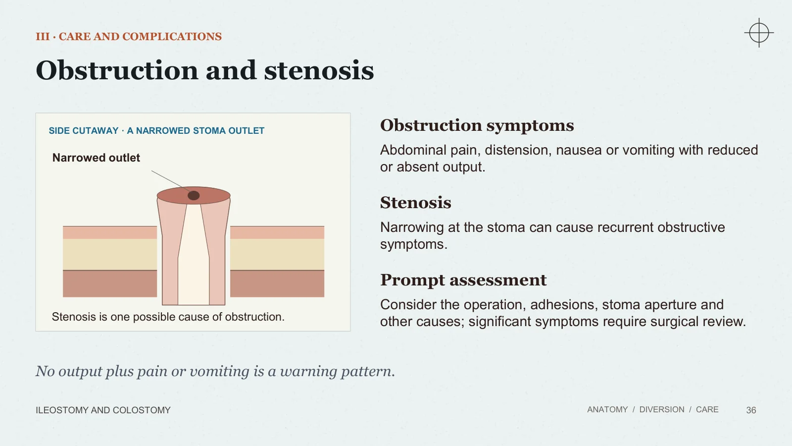 Slide 36: Obstruction and stenosis