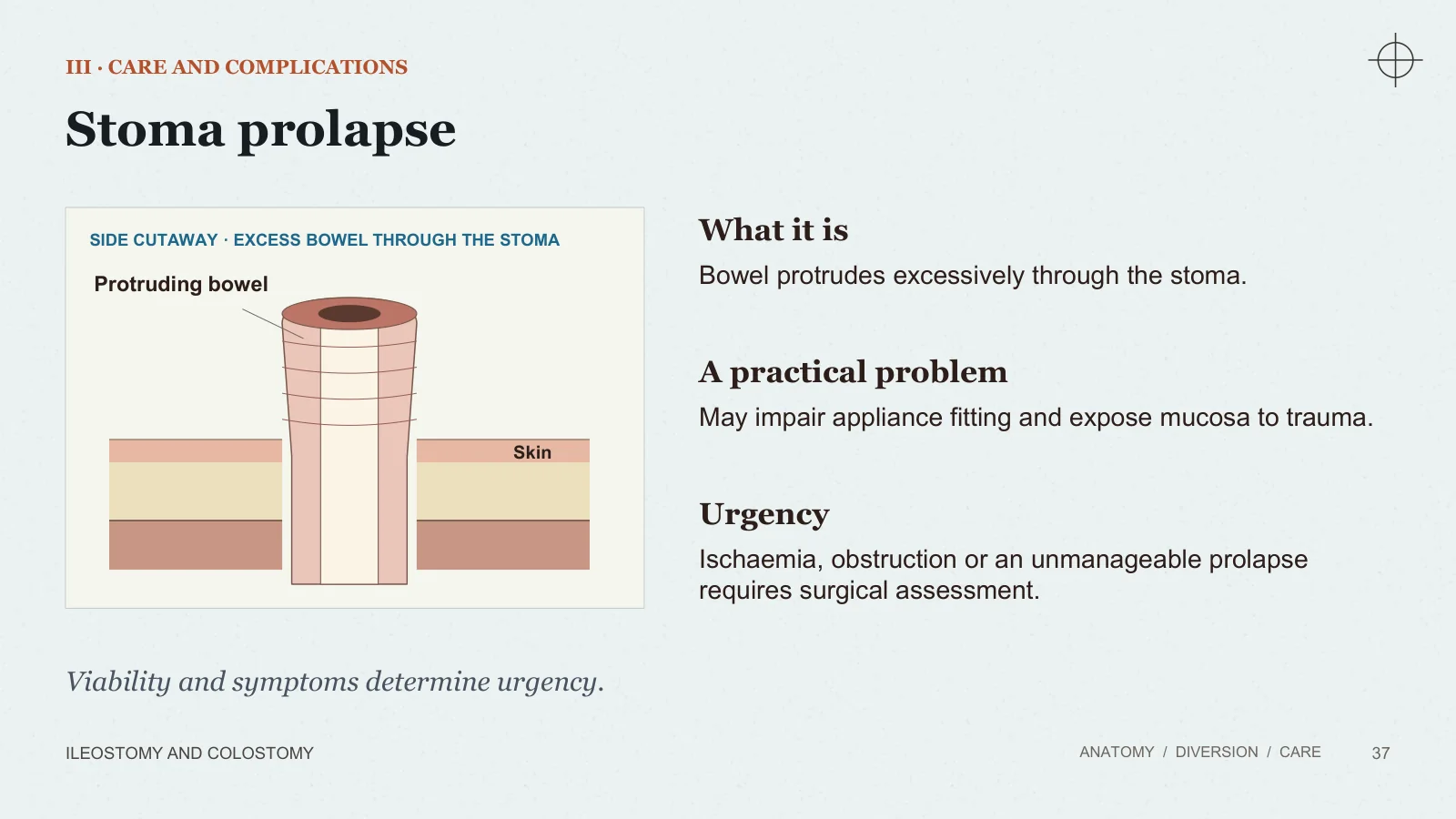 Slide 37: Stoma prolapse