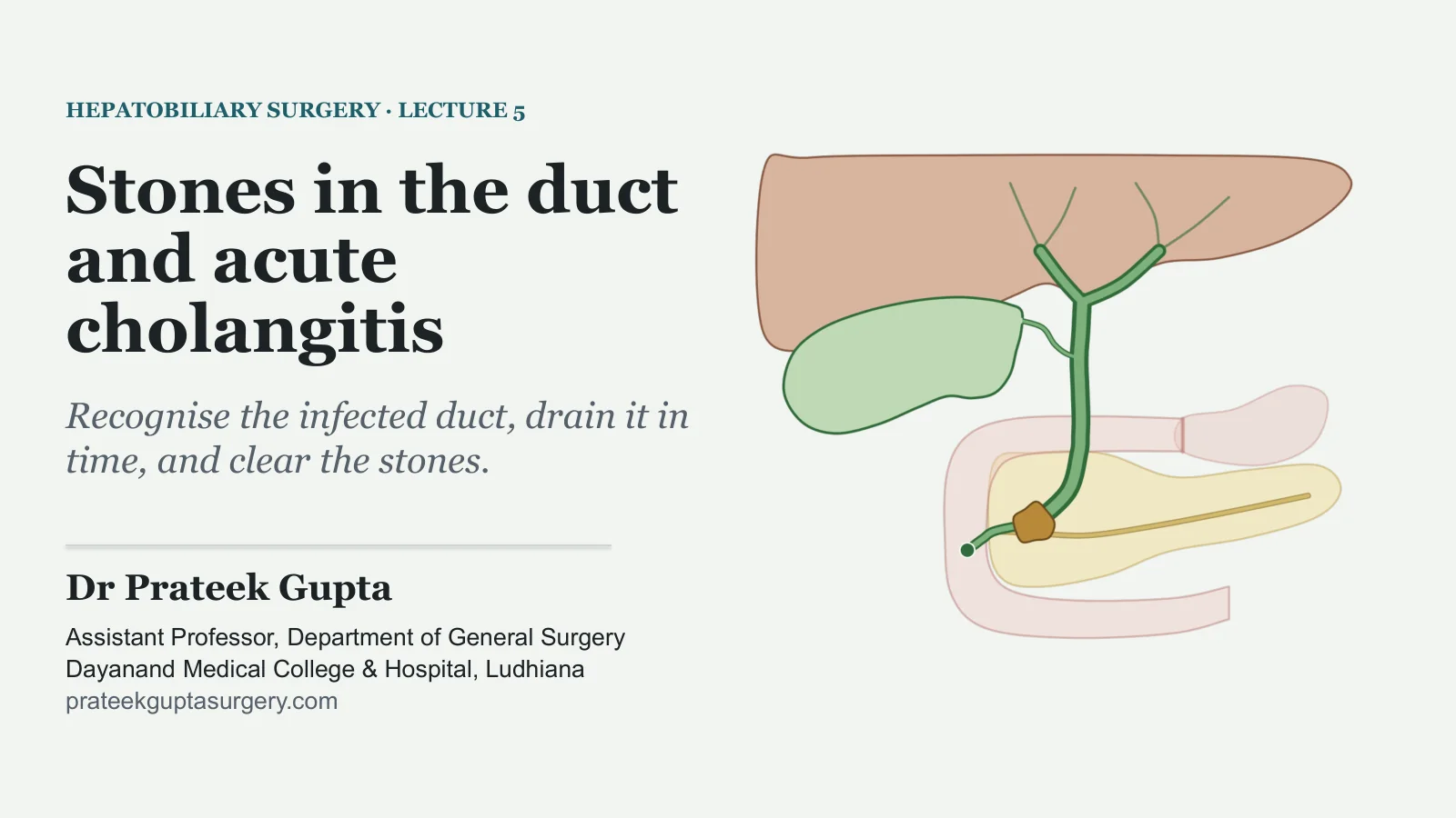 Slide 1: Stones in the duct and acute cholangitis