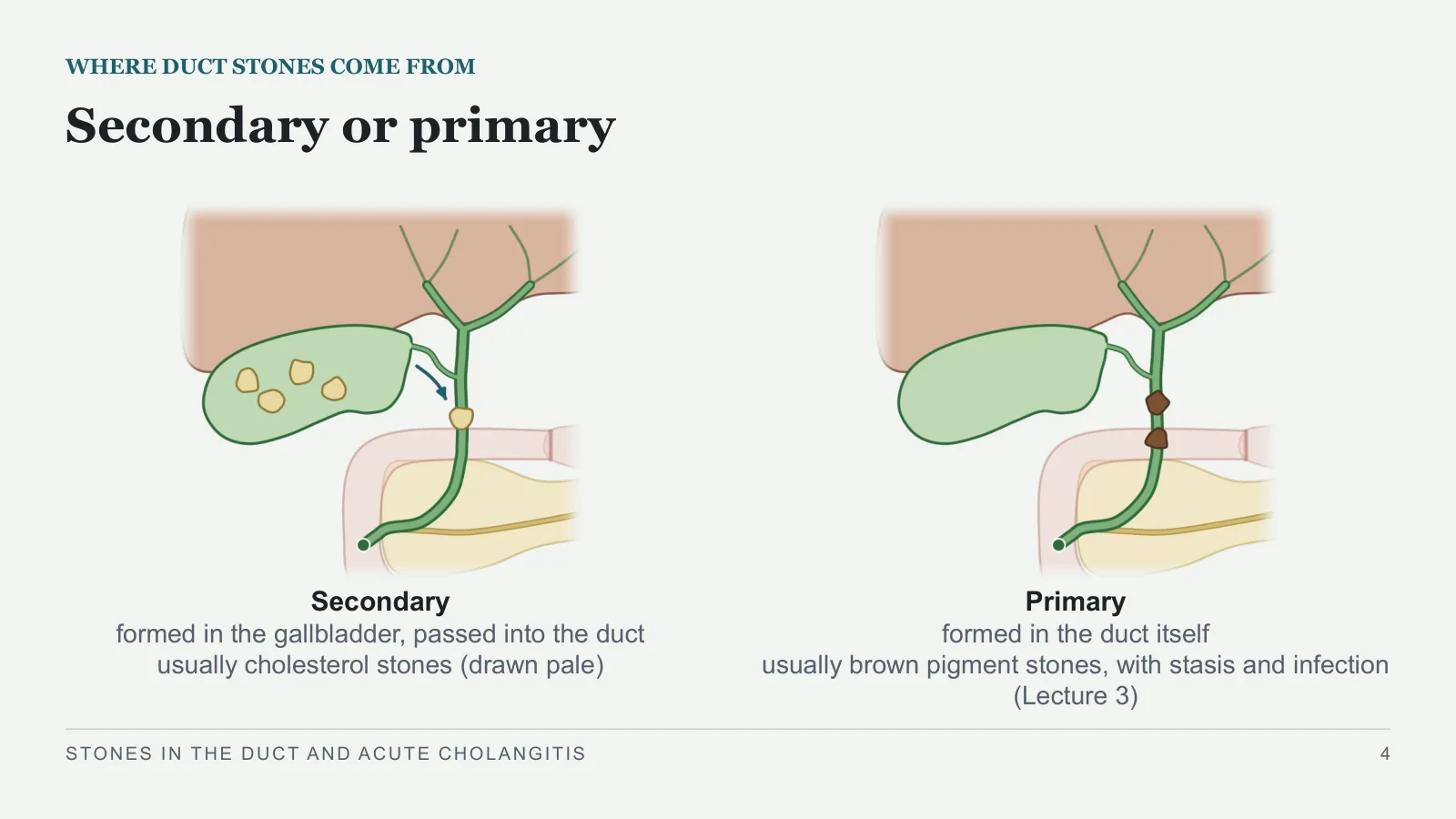 Slide 4: Secondary or primary